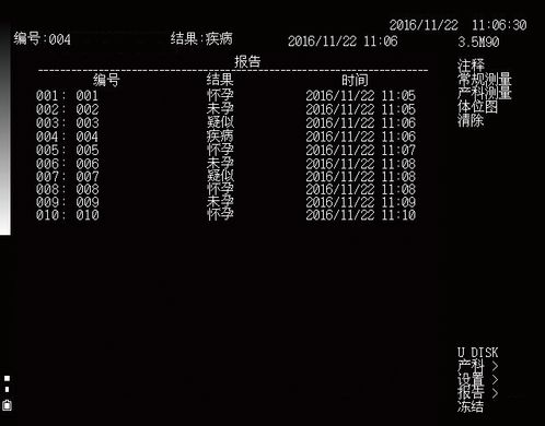 УЗД апарат для свинарства MSU1 PLUS Kaixin