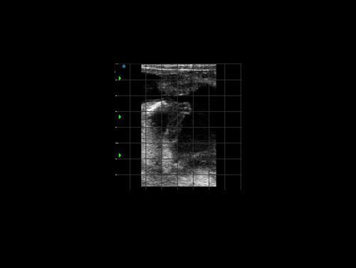 Ветеринарный УЗИ сканер SIUI Apogee CTS-800