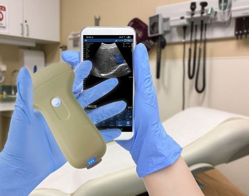 Беспроводной конвексный УЗИ-датчик BIOSCAN Probe 3C