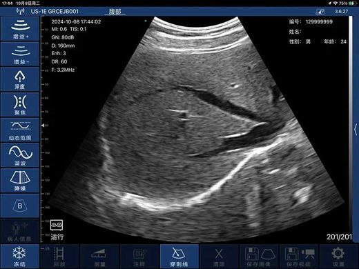Беспроводной конвексный УЗИ-датчик BIOSCAN Probe 3C
