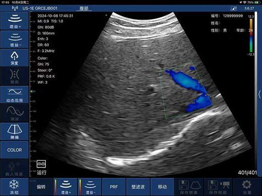 Беспроводной конвексный УЗИ-датчик BIOSCAN Probe 3C