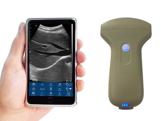 Беспроводной конвексный УЗИ-датчик BIOSCAN Probe 3C