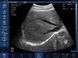 Беспроводной конвексный УЗИ-датчик BIOSCAN Probe 3C