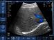 Беспроводной конвексный УЗИ-датчик BIOSCAN Probe 3C